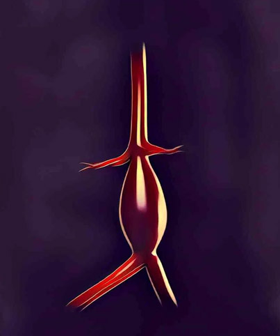 aorta